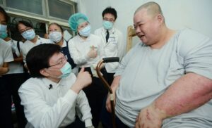 病患「阿富」在醫療團隊與志工的協助下，成功從280公斤減重至96公斤，重拾生活與自信。